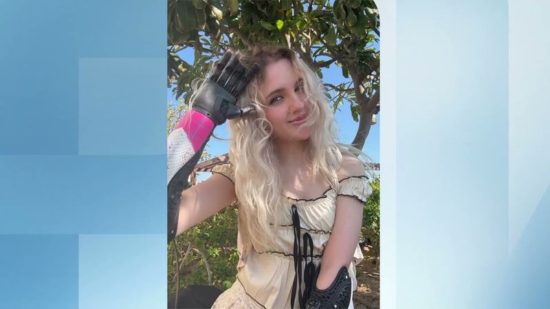 Тили Локи – инфлуенсърката с роботизирани ръце, която отлепя етикета „различен”