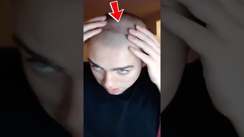 КОСТИ 🦴 - ДИНАМИЧНЕЙ, ЧЕМ МЫШЦЫ! Деформация черепа при ношении 🎧