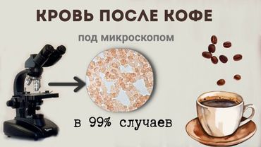 Как употребление кофе чаще всего влияет на кровь.