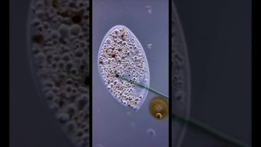 Жизнь одной клетки: Инфузория