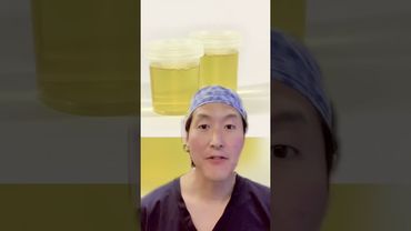 Cosa succede se bevi la pipì? Urinoterapia?!?! 😳😳 #shorts