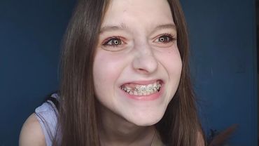 Styling new clothes I got! + I just got braces!