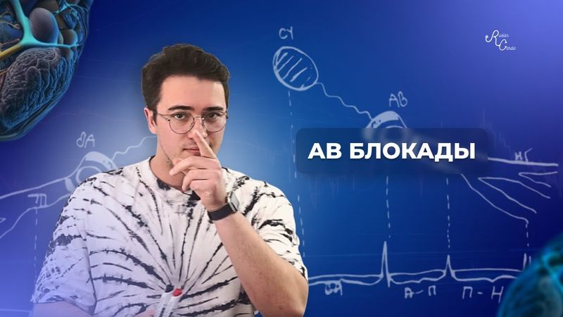 Атриовентрикулярные блокады