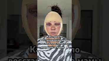 За красоту спасибо клинике  «Лиенджан» 🥹🙏🏻 #корейцы #корея #жизньвкорее #пластикавкорее