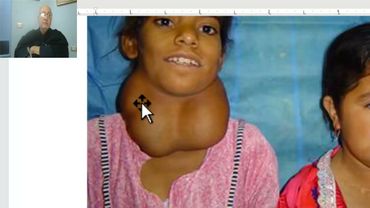 Anatomy of head and neck module in Arabic 62 (Thyroid gland , part 3) , Dr. Wahdan