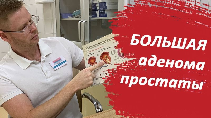 Большая аденома простаты / Доктор Черепанов