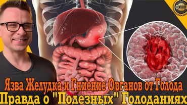 Язва желудка и гниение органов от голода! Вся правда о «ПОЛЕЗНЫХ» голоданиях!