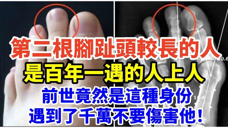 第二根腳趾頭較長的人，是百年一遇的人上人，前世竟然是這種身份，遇到了千萬不要傷害他！