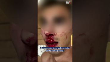Novi incident između zaštitara i turista