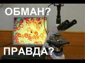 Как обманывают людей, показывая кровь на темнопольном микроскопе? Показал правду Середа Михаил.