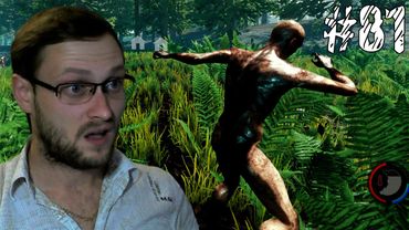 The Forest ► ОТВРАТИТЕЛЬНЫЙ СТЕЛС ► #81