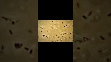 At least 10 people sickened in US listeria outbreak linked to prepared foods