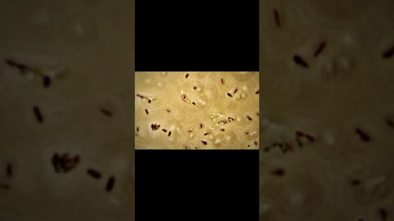 At least 10 people sickened in US listeria outbreak linked to prepared foods