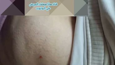 اخت بتدى صحبتها حقنة 💉ڤيتامين في العضل💉 بس بت😫وجع
