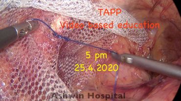 TAPP - Video based education