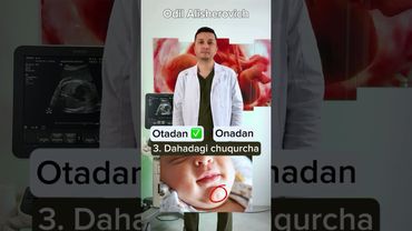 Bu belgilar KIMDAN  o‘tadi, BILIB oling! 📞+998 90 046 74 41 Gs Medical. #scrining #uzi #doppler #ona