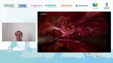 А. Аболмасов E-TEP пластика при паховой грыже