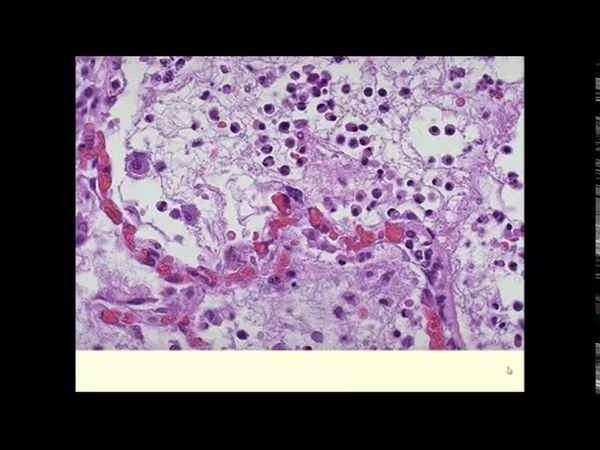 Лекция № 4 для студентов  МПД, лечебного и педиатрического факультетов СГМУ им. В.И. Разумовского