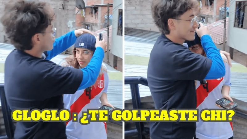 EMI SE GOLPEA LA CABEZA Y GLOGLO LA ABRAZA