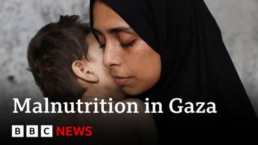 Warnings of malnutrition in Gaza as Donald Trump says Hamas won’t agree ceasefire | BBC News