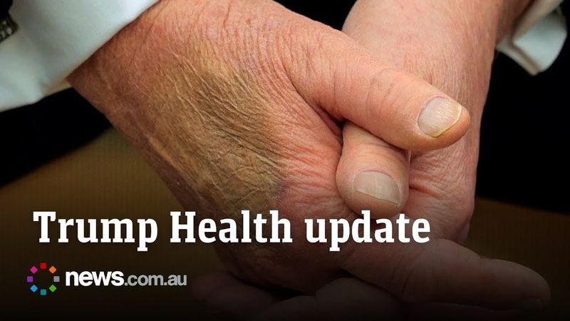 Bruising and swelling explained as White House reveals Trump's 'chronic' health condition