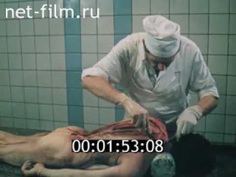 Повешенный(16+) Судебно  медицинская экспертиза механической асфиксии (1990) для студентов медвузов