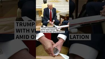 Trump diagnosed with vein issue after leg swelling and hand bruising | AFP #shorts