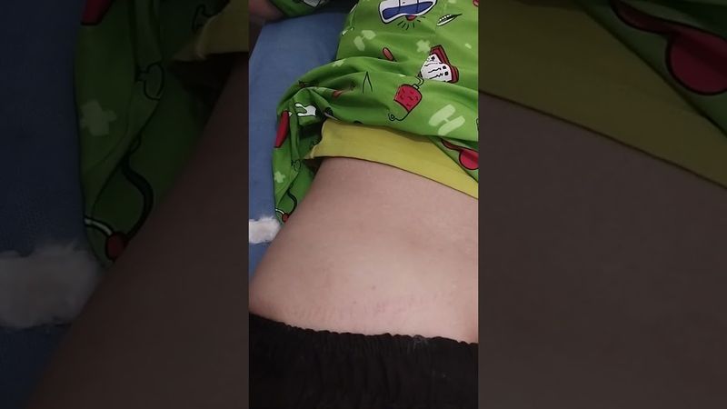 Aplicación de inyectologia intramuscular