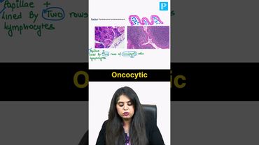 Salivary Gland Pathology by Dr. Preeti Sharma