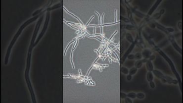 Как за часы вырастает грибковая колония