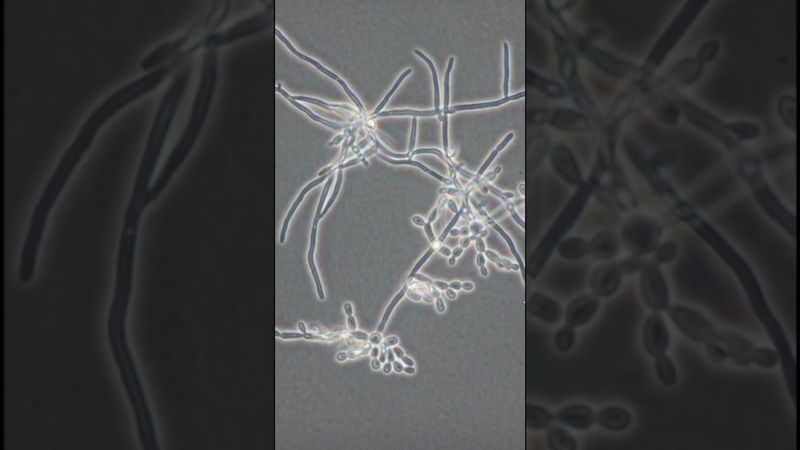 Как за часы вырастает грибковая колония