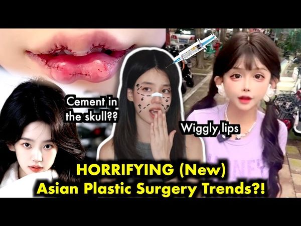 Asian plastic surgeries are getting OUT OF CONTROL...