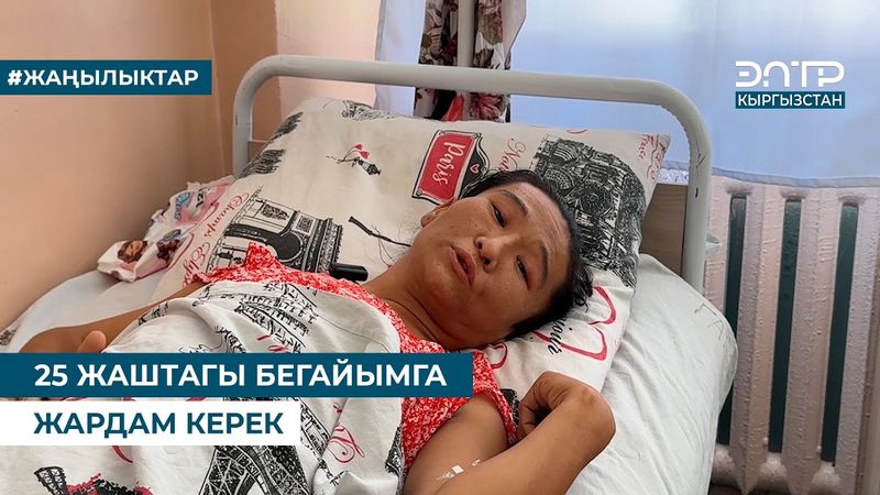 25 ЖАШТАГЫ БЕГАЙЫМГА ЖАРДАМ КЕРЕК