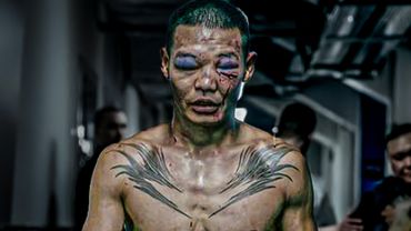 The Worst Damage You'll See In Russian Bare Knuckle