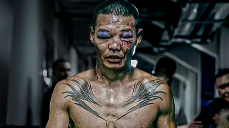 The Worst Damage You'll See In Russian Bare Knuckle