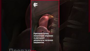 Ирандобилсяпрорывараннейдиагностикекрытыхопухолейнадпочечников