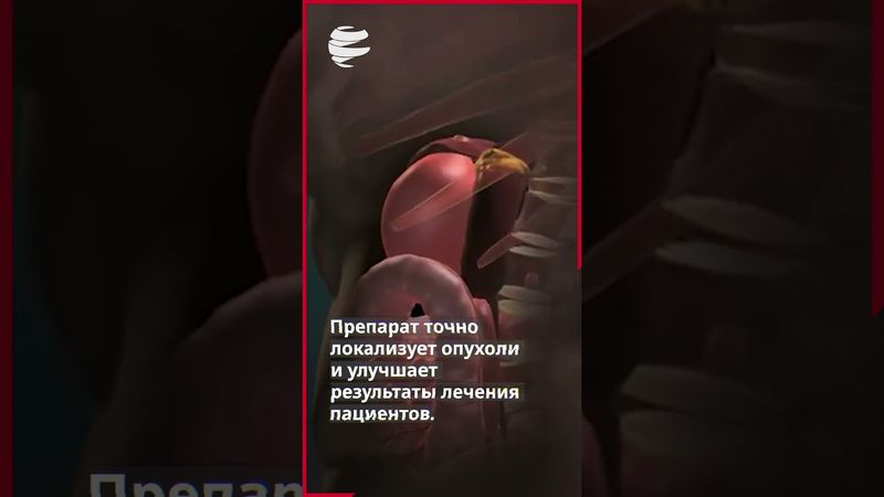 Ирандобилсяпрорывараннейдиагностикекрытыхопухолейнадпочечников