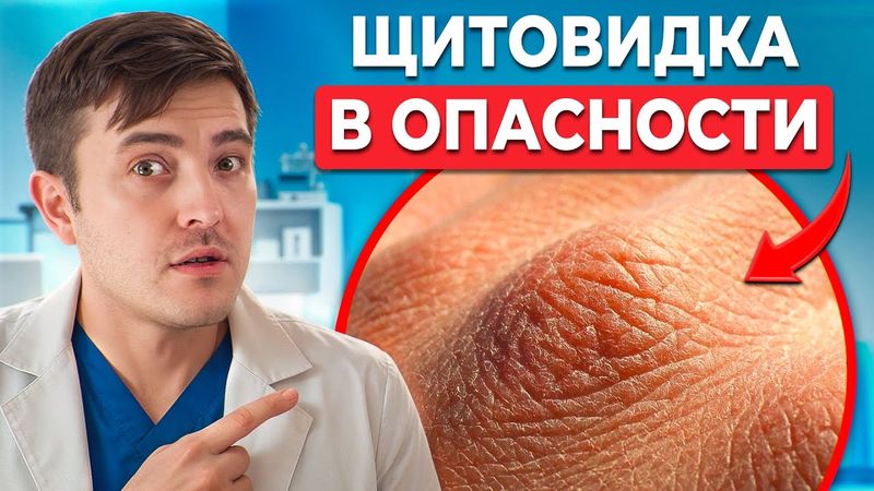 Как кожа предупреждает о ПРОБЛЕМАХ С ЩИТОВИДКОЙ? Заметь, пока не поздно!