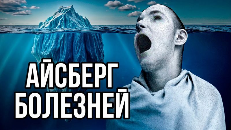 Айсберг ЖУТКИХ болезней