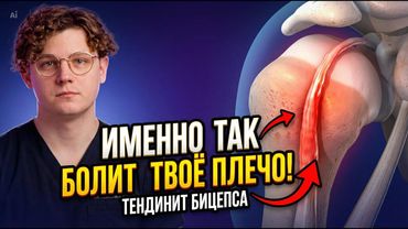 Одна из главных причин болей в плече! Тендинит сухожилия длинной головки бицепса.
