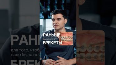 Выравнять зубы БЕЗ БРЕКЕТОВ