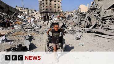 Children in Gaza 'like zombies' because of severe malnutrition, US doctor says | BBC News