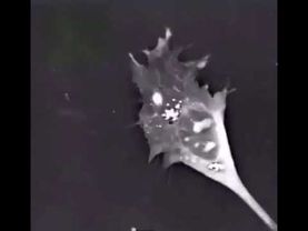 Смерть нейрона