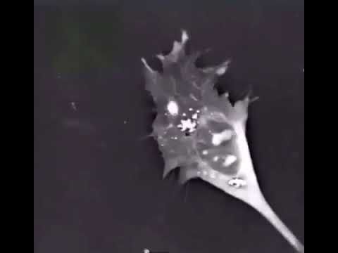 Смерть нейрона