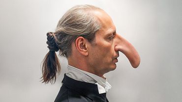 Этот человек жил с носом больше, чем ваше предплечье