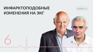 ЭКГ и «Диагноз в двери». Часть IV. 10.04.24