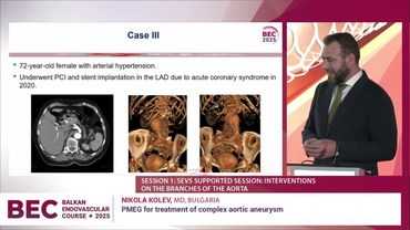 BEC 2025  PMEG for treatment of complex aortic aneurysm ⋆ Nikola Kolev