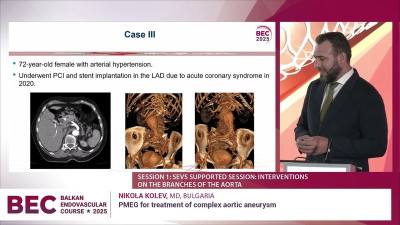 BEC 2025 PMEG for treatment of complex aortic aneurysm ⋆ Nikola Kolev
