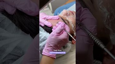 Механическая чистка лица