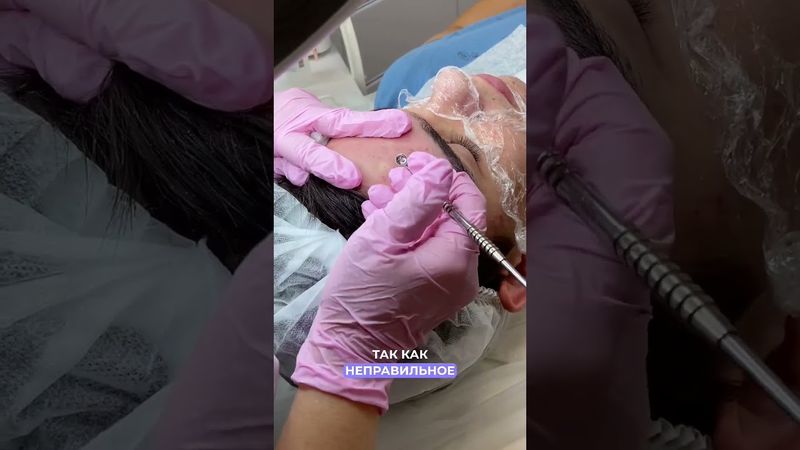 Механическая чистка лица